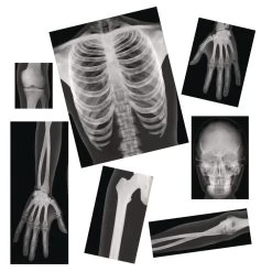 Excellerations® Science Kit - Health And Human Body 8 Excellerations® Science Kit - Health And Human Body -Children School Supplies S699994 1